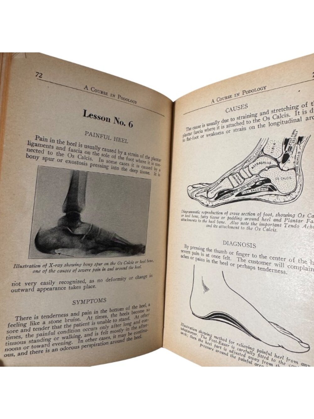 A Course in Podology National School of Podology Illust 1st Edition 1932 HC Book - Picture 9 of 16